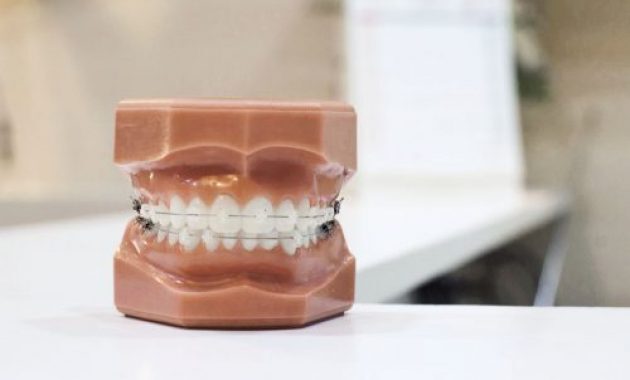 10 Dokter Gigi di Malang Yang Bagus dan Murah 2