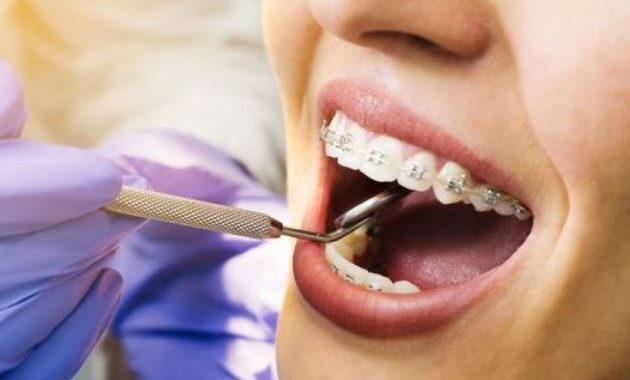 10 Daftar Dokter Gigi di Samarinda Yang Bagus dan Murah 3