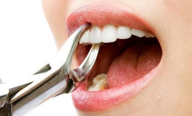 10 Alamat Dokter Spesialis Gigi di Kediri 9