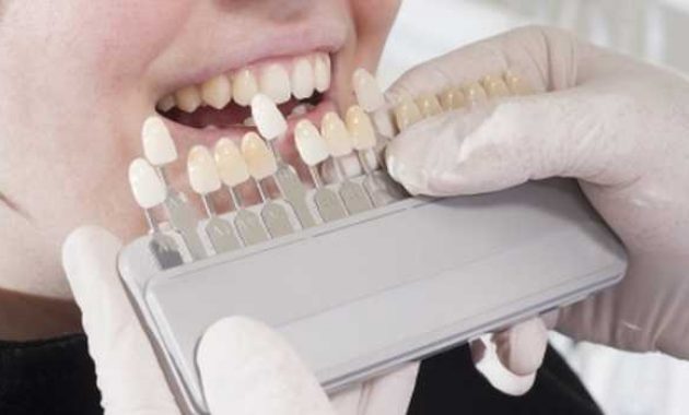 10 Dokter Gigi di Jakarta Selatan Yang Bagus Buat Anak 9 10 Dokter Gigi di Jakarta Selatan Yang Bagus Buat Anak 9