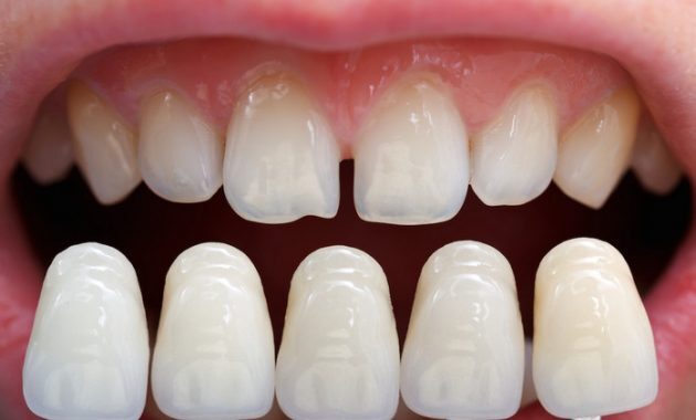 10 Daftar Pilihan Jadwal Praktek Dokter Gigi Terkenal dan Terbaik di Daerah Tegal 1