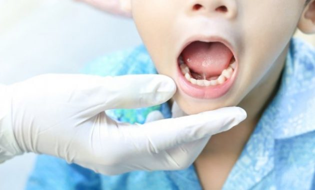 10 Daftar Pilihan Nama Dokter Gigi di Daerah Tulungagung, Lengkap Dengan Jam Buka 6