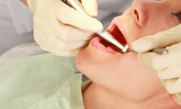 10 Daftar Pilihan Praktek Dokter Gigi Yang Murah dan Bagus di Daerah Bali 10 10 Daftar Pilihan Praktek Dokter Gigi Yang Murah dan Bagus di Daerah Bali 10