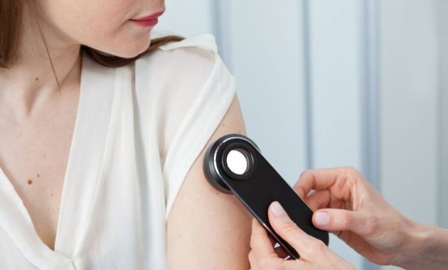 Rekomendasi Dokter Kulit Yang Bisa Kamu Andalkan Disaat Terserang Gangguan di Probolinggo 1